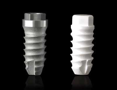 Titanium and ceramic implants provide strong protections for your teeth.